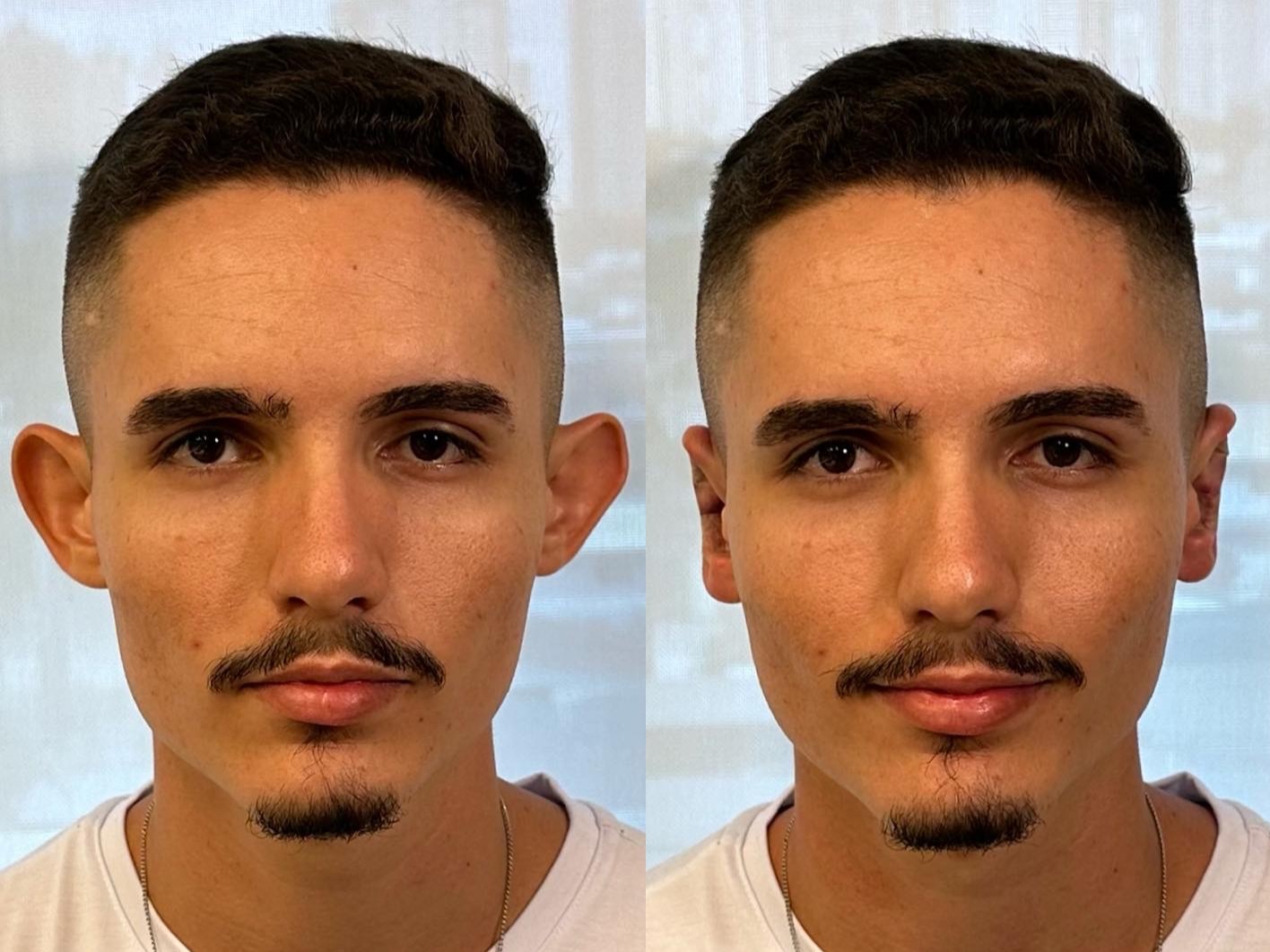 Resultado Paciente 3